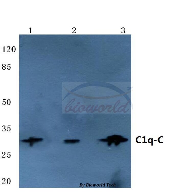 Anti-C1q-C (Q119) Antibody from Bioworld Technology (BS3838) - Antibodies.com