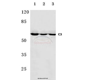 Anti-C9 (H216) Antibody from Bioworld Technology (BS3841) - Antibodies.com