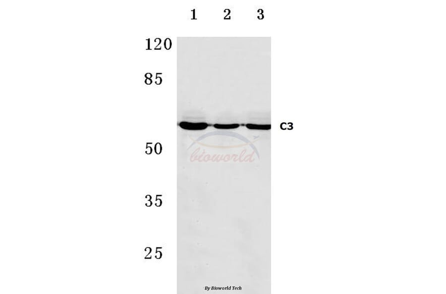 Anti-C9 (H216) Antibody from Bioworld Technology (BS3841) - Antibodies.com