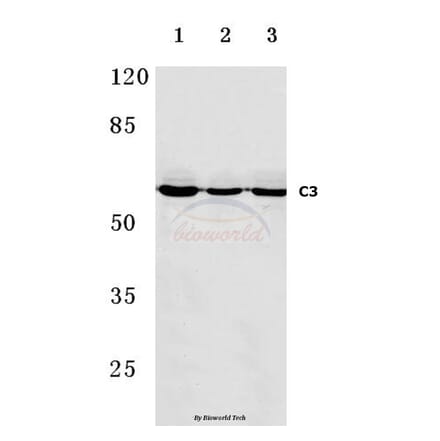 Anti-C9 (H216) Antibody from Bioworld Technology (BS3841) - Antibodies.com