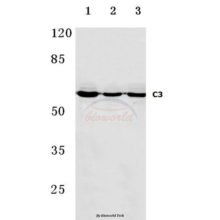 Anti-C9 (H216) Antibody from Bioworld Technology (BS3841) - Antibodies.com