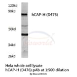 Anti-hCAP-H (D476) Antibody from Bioworld Technology (BS3843) - Antibodies.com