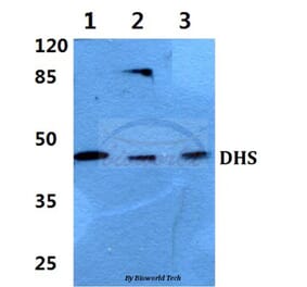 Anti-DHS (L87) Antibody from Bioworld Technology (BS3847) - Antibodies.com