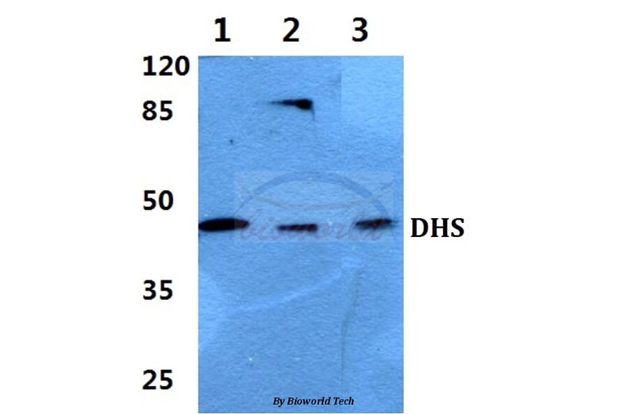 Anti-DHS (L87) Antibody from Bioworld Technology (BS3847) - Antibodies.com