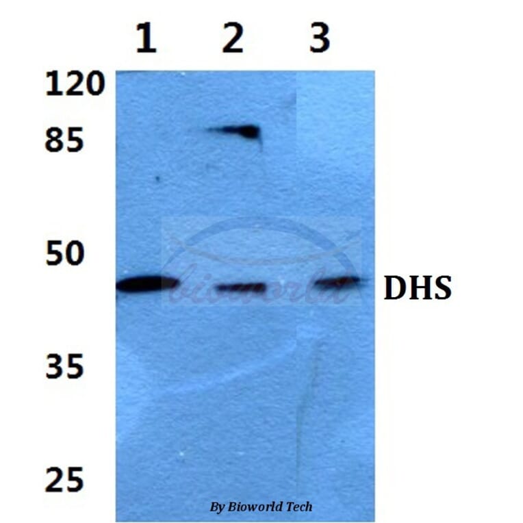 Anti-DHS (L87) Antibody from Bioworld Technology (BS3847) - Antibodies.com