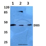 Anti-DHS (L87) Antibody from Bioworld Technology (BS3847) - Antibodies.com