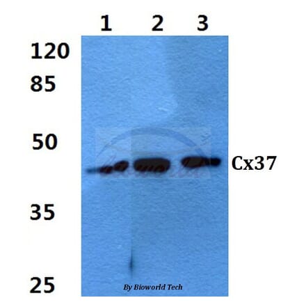 Anti-Connexin 37 (L116) Antibody from Bioworld Technology (BS3866) - Antibodies.com