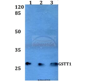 Anti-GSTT1 (R31) Antibody from Bioworld Technology (BS3869) - Antibodies.com
