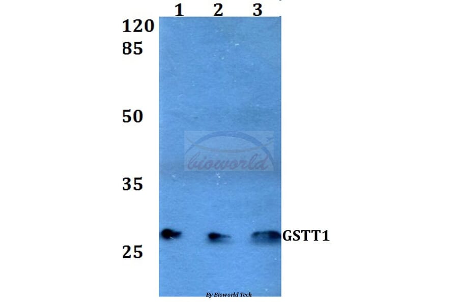Anti-GSTT1 (R31) Antibody from Bioworld Technology (BS3869) - Antibodies.com