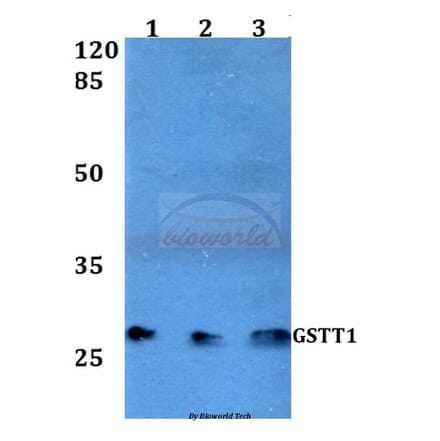 Anti-GSTT1 (R31) Antibody from Bioworld Technology (BS3869) - Antibodies.com