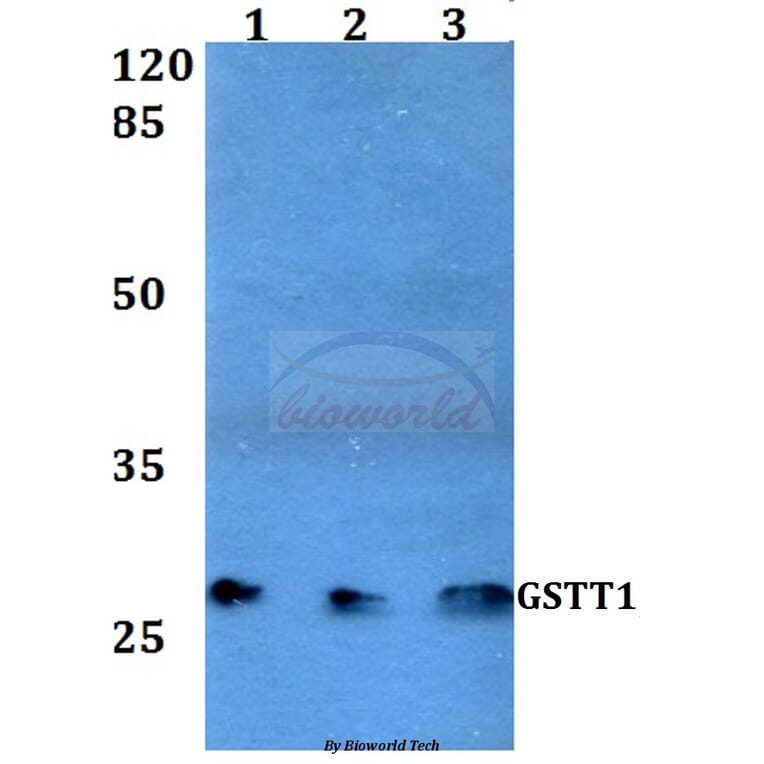 Anti-GSTT1 (R31) Antibody from Bioworld Technology (BS3869) - Antibodies.com