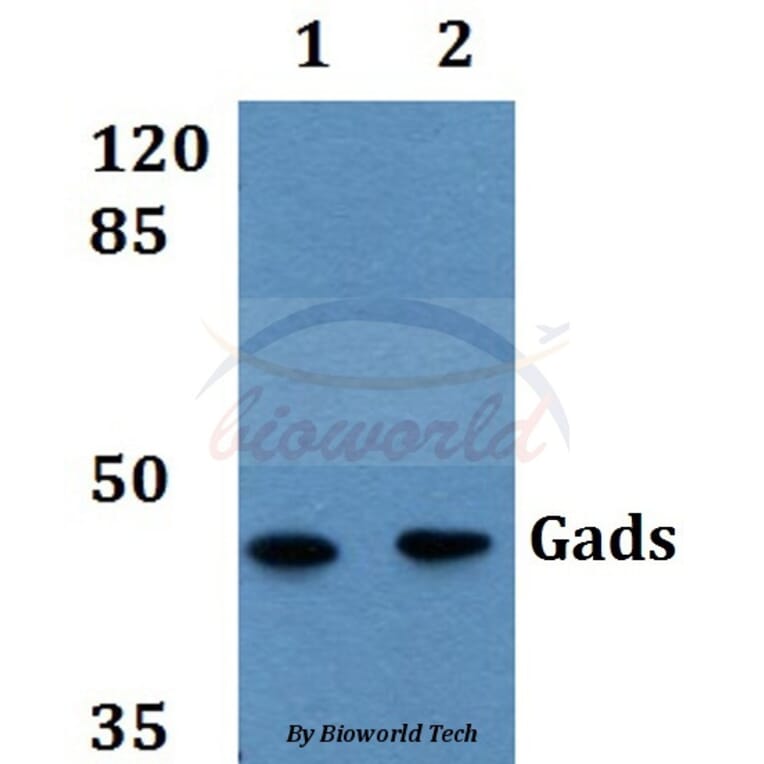 Anti-Gads (N158) Antibody from Bioworld Technology (BS3870) - Antibodies.com