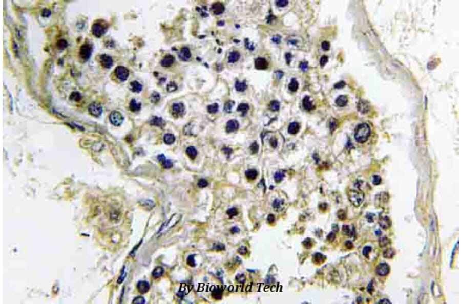 Anti-Gα t2 (V34) Antibody from Bioworld Technology (BS3874) - Antibodies.com