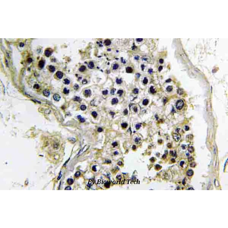 Anti-Gα t2 (V34) Antibody from Bioworld Technology (BS3874) - Antibodies.com