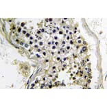Anti-Gα t2 (V34) Antibody from Bioworld Technology (BS3874) - Antibodies.com