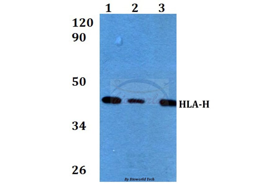 Anti-HLA-H (I104) Antibody from Bioworld Technology (BS3876) - Antibodies.com
