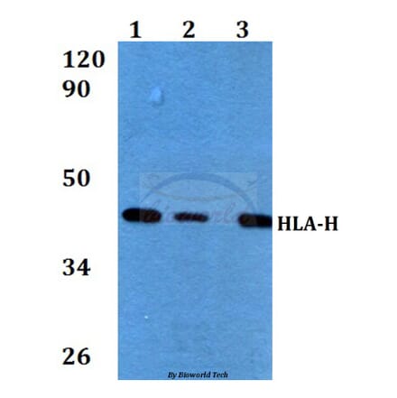 Anti-HLA-H (I104) Antibody from Bioworld Technology (BS3876) - Antibodies.com