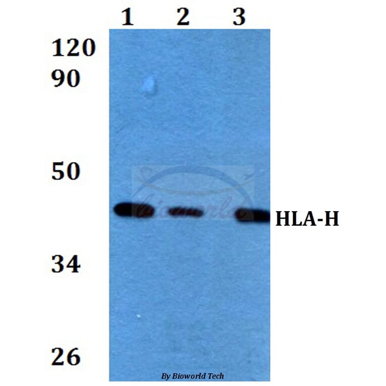 Anti-HLA-H (I104) Antibody from Bioworld Technology (BS3876) - Antibodies.com