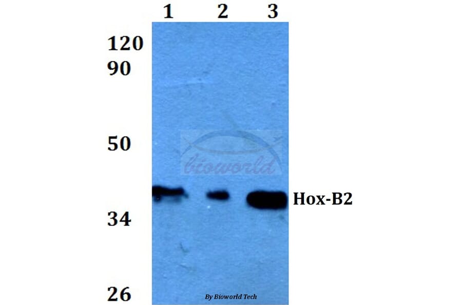 Anti-Hox-B2 (P67) Antibody from Bioworld Technology (BS3877) - Antibodies.com