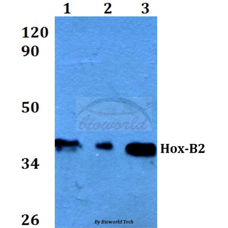 Anti-Hox-B2 (P67) Antibody from Bioworld Technology (BS3877) - Antibodies.com
