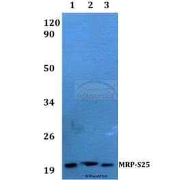 Anti-MRP-S25 (K168) Antibody from Bioworld Technology (BS3880) - Antibodies.com