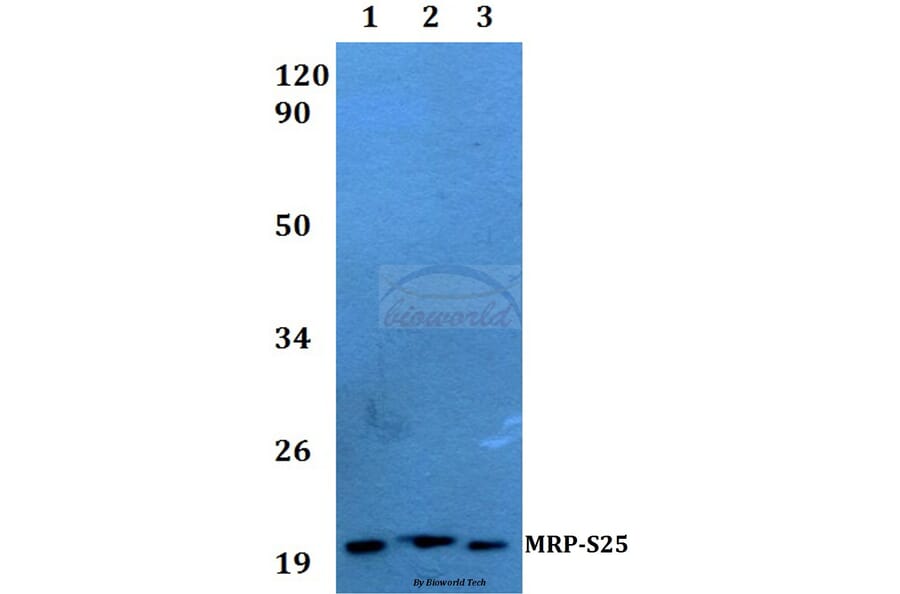 Anti-MRP-S25 (K168) Antibody from Bioworld Technology (BS3880) - Antibodies.com