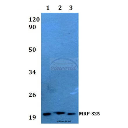 Anti-MRP-S25 (K168) Antibody from Bioworld Technology (BS3880) - Antibodies.com