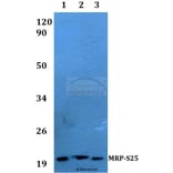 Anti-MRP-S25 (K168) Antibody from Bioworld Technology (BS3880) - Antibodies.com