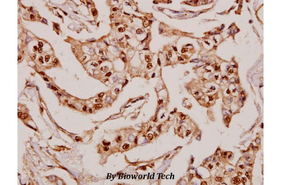 Anti-MRP-S36 (V36) Antibody from Bioworld Technology (BS3881) - Antibodies.com