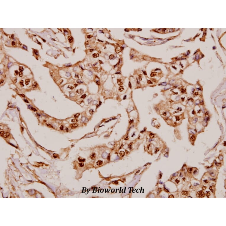Anti-MRP-S36 (V36) Antibody from Bioworld Technology (BS3881) - Antibodies.com