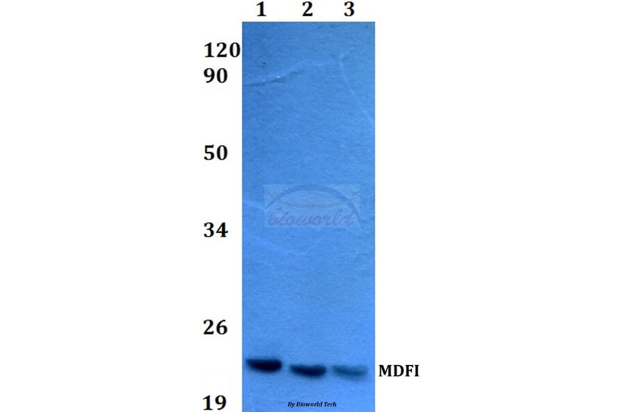 Anti-MDFI (P134) Antibody from Bioworld Technology (BS3882) - Antibodies.com