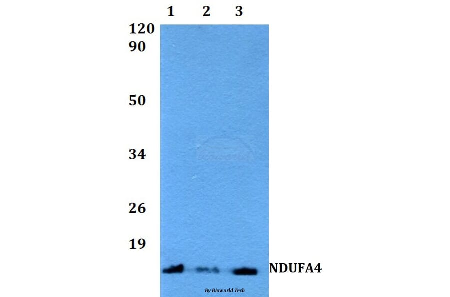 Anti-NDUFA4 (F81) Antibody from Bioworld Technology (BS3883) - Antibodies.com