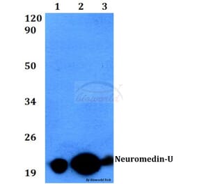 Anti-Neuromedin-U (I174) Antibody from Bioworld Technology (BS3892) - Antibodies.com