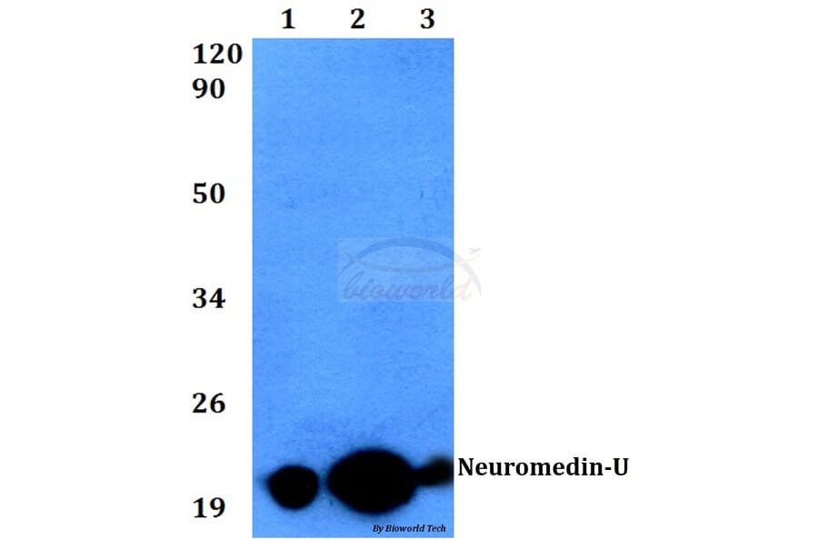 Anti-Neuromedin-U (I174) Antibody from Bioworld Technology (BS3892) - Antibodies.com