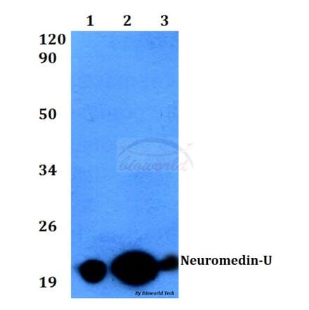 Anti-Neuromedin-U (I174) Antibody from Bioworld Technology (BS3892) - Antibodies.com