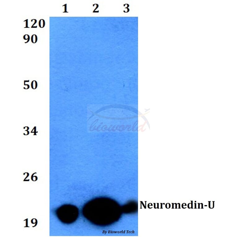 Anti-Neuromedin-U (I174) Antibody from Bioworld Technology (BS3892) - Antibodies.com