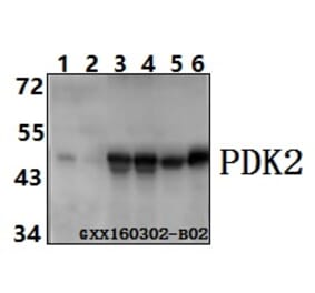 Anti-PDK2 (R291) Antibody from Bioworld Technology (BS3913) - Antibodies.com