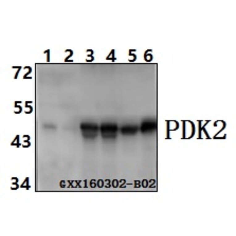 Anti-PDK2 (R291) Antibody from Bioworld Technology (BS3913) - Antibodies.com