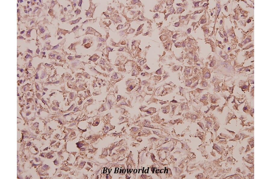 Anti-Rab 5C (A153) Antibody from Bioworld Technology (BS3919) - Antibodies.com