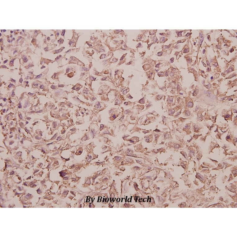 Anti-Rab 5C (A153) Antibody from Bioworld Technology (BS3919) - Antibodies.com