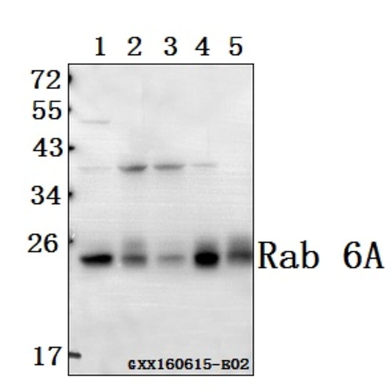 Anti-Rab 6A (K144) Antibody from Bioworld Technology (BS3920) - Antibodies.com
