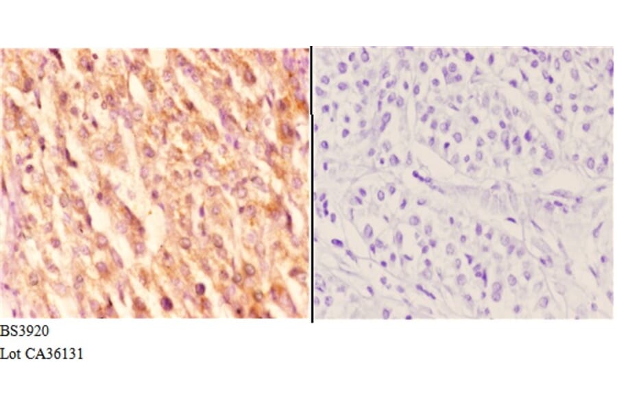 Anti-Rab 6A (K144) Antibody from Bioworld Technology (BS3920) - Antibodies.com