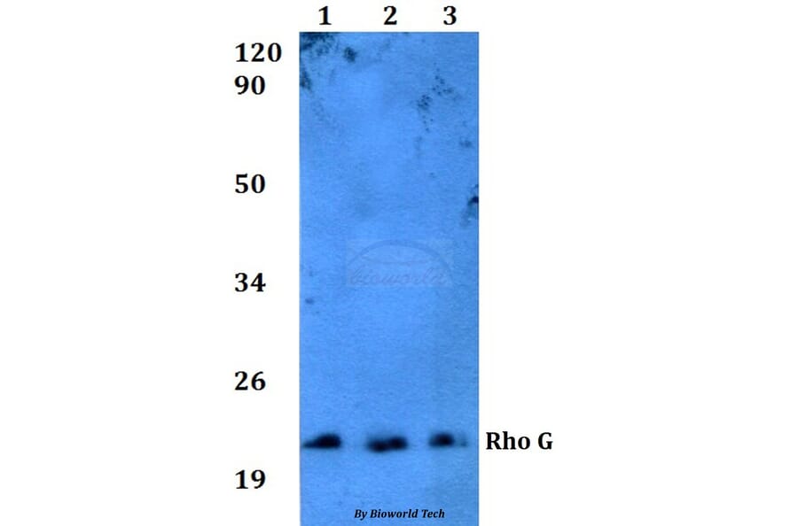 Anti-Rho G (Q132) Antibody from Bioworld Technology (BS3931) - Antibodies.com