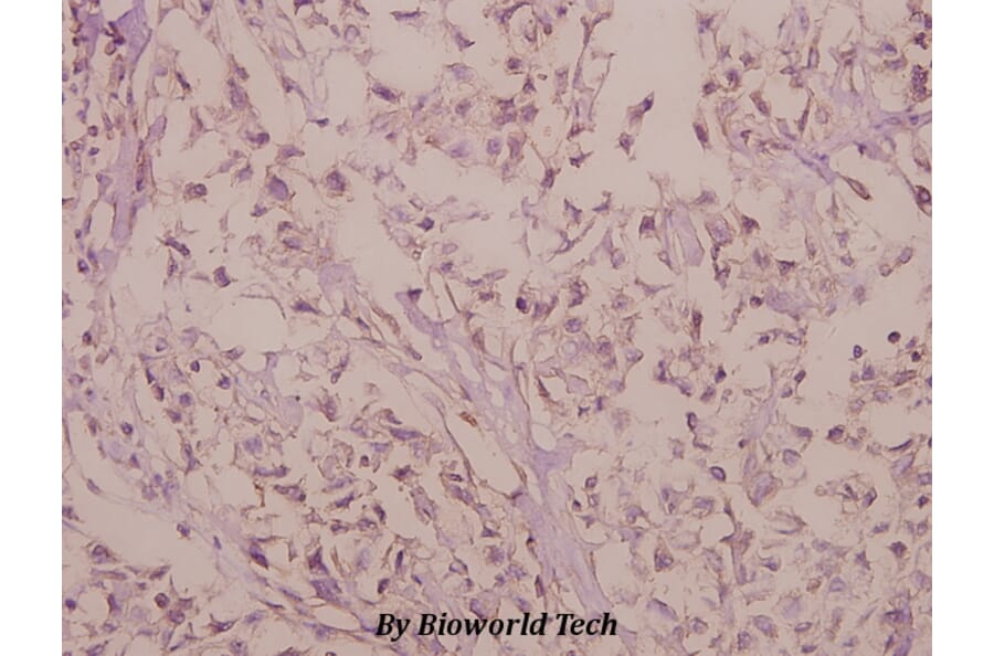 Anti-Rho G (Q132) Antibody from Bioworld Technology (BS3931) - Antibodies.com