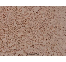 Anti-RRS1 (R286) Antibody from Bioworld Technology (BS3932) - Antibodies.com