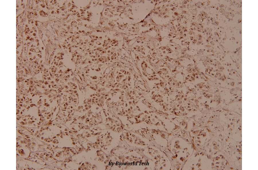 Anti-RRS1 (R286) Antibody from Bioworld Technology (BS3932) - Antibodies.com
