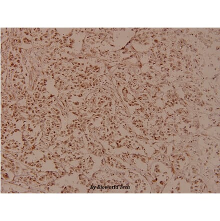 Anti-RRS1 (R286) Antibody from Bioworld Technology (BS3932) - Antibodies.com