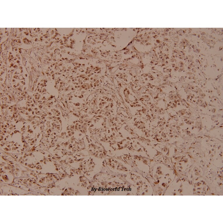 Anti-RRS1 (R286) Antibody from Bioworld Technology (BS3932) - Antibodies.com