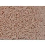 Anti-RRS1 (R286) Antibody from Bioworld Technology (BS3932) - Antibodies.com