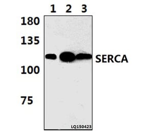 Anti-SERCA1 (D580) Antibody from Bioworld Technology (BS3934) - Antibodies.com